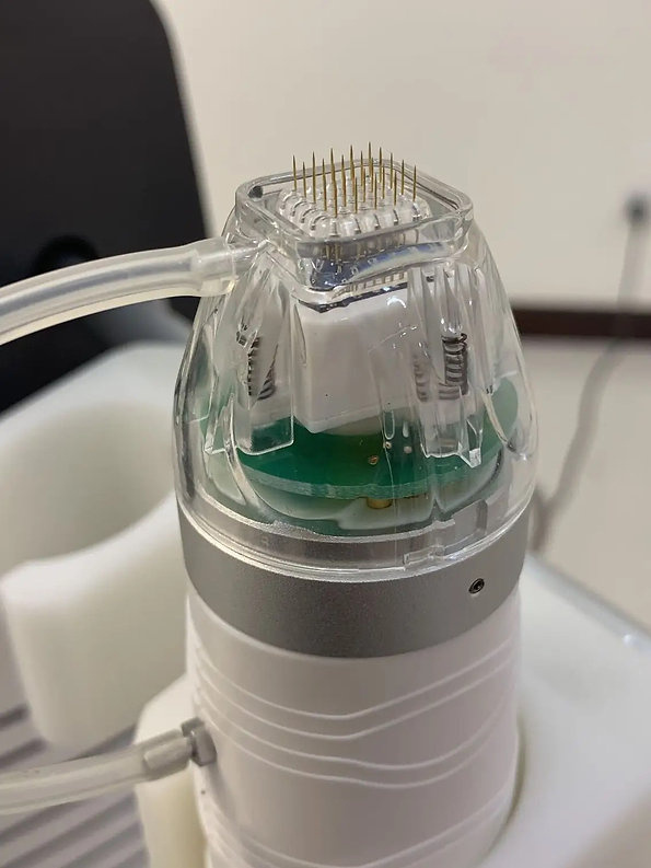 Аппарат микроигольчатого RF лифтинга QUANTUS NEEDLE RF фото 11